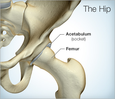 hip replacement Chhabra Hospital
